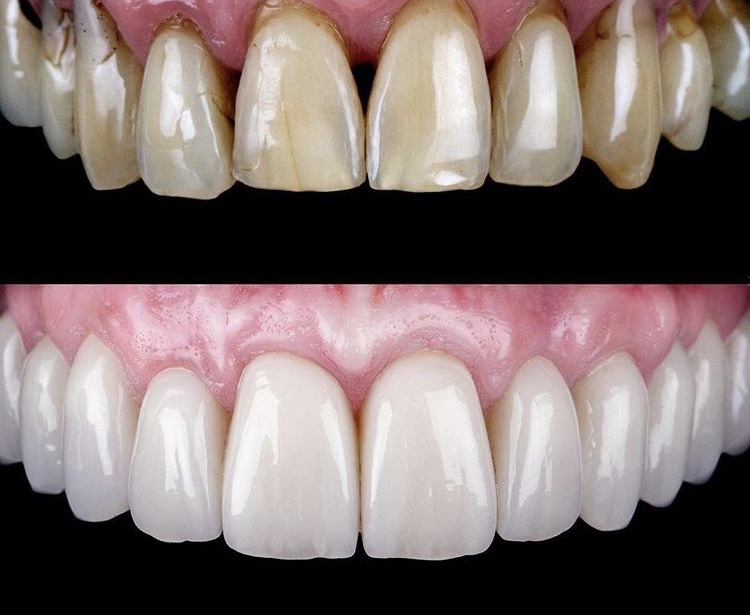 Radiant Smiles Dentistry